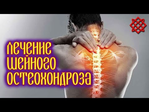 ЛЕЧЕНИЕ ШЕЙНОГО ОСТЕОХОНДРОЗА НАРОДНЫМИ СРЕДСТВАМИ. Как Вылечить Остеохондроз