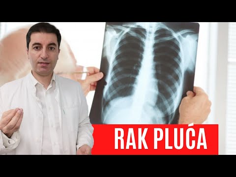 Video: Mogu li loša leđa uzrokovati probleme s disanjem?