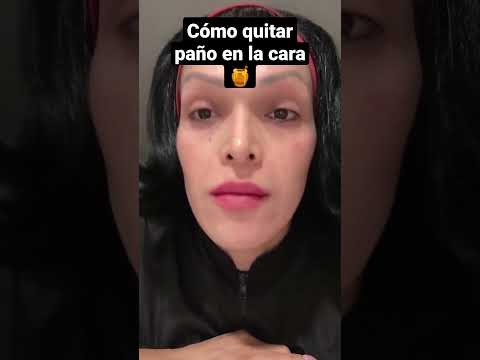 cómo quitar y