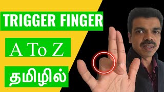 Best physiotherapy treatment for trigger finger and trigger thumb..Dr.s.girish physio