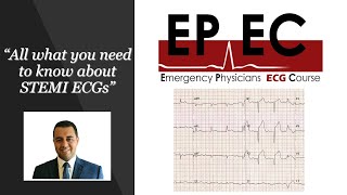 #EPEC ECG Cases (Case 05). All what you need to know about STEMI ECGs.