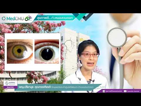 สุขภาพดีกับหมอสวนดอก : ตรวจจอประสาทตา ด้วยการขยายม่านตา คืออะไร ? 👁👁