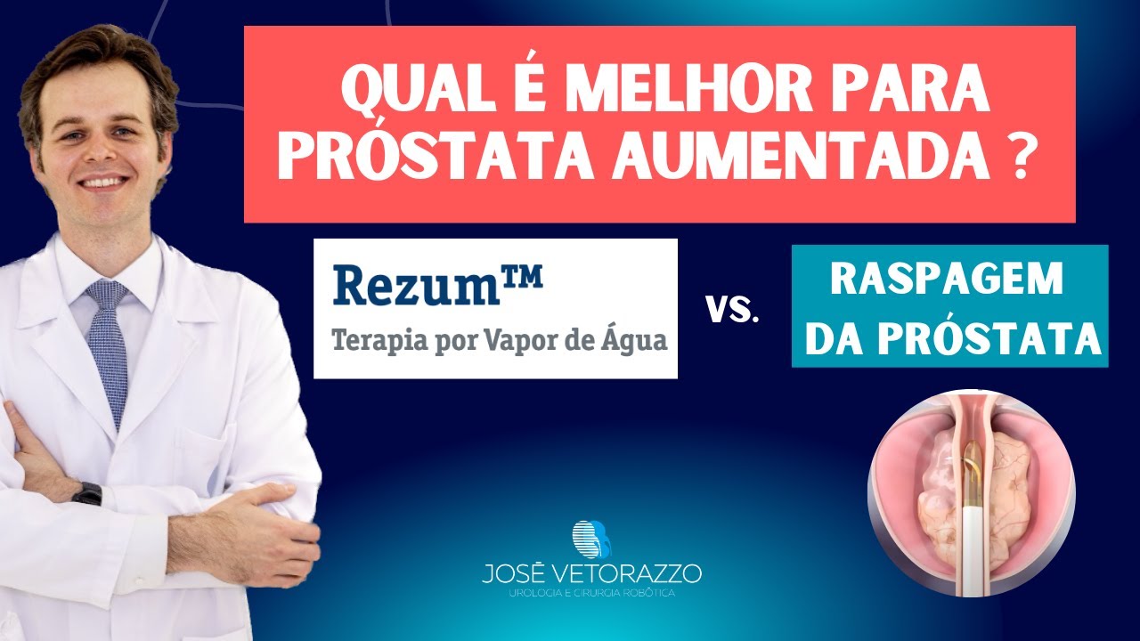 REZUM ou RASPAGEM DA PRÓSTATA - Qual o Melhor tratamento para Próstata ...