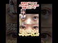【切り抜き】涙袋のデザインで人生が変わった女性の感動エピソード#shorts #しのぶ皮膚科 #ヒアルロン酸 #美容医療 #美容 #美容整形