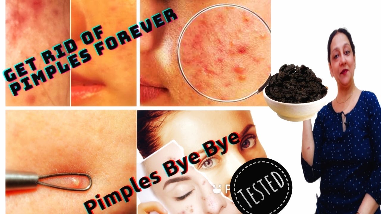 How to Clear Acne and pimples Raisins and fennel seeds for pimple