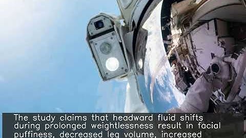 Zero gravity made some astronauts