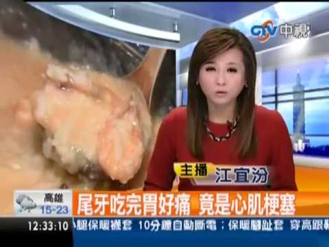可愛慧蓉提醒心痛或胃痛