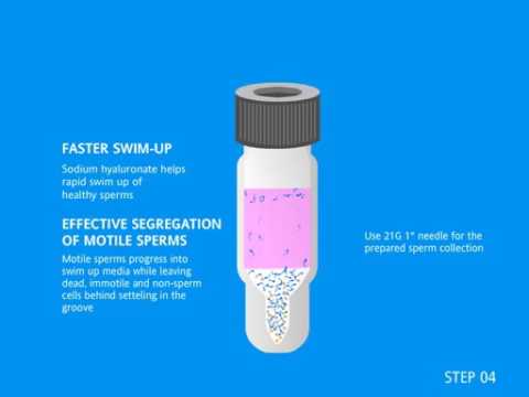 Video: 5-hidroksimetilcitozinas Ir Jo Galimas Vaidmuo Vystymuisi Ir Vėžiui