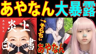 あやなん 「炎上白書」の内容がヤバすぎ！【誕生日会 31人飲み会YouTuber 水溜りボンド トミー】