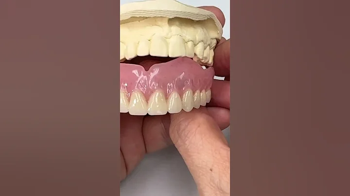 New immediate denture for this patient All teeth will be extract!