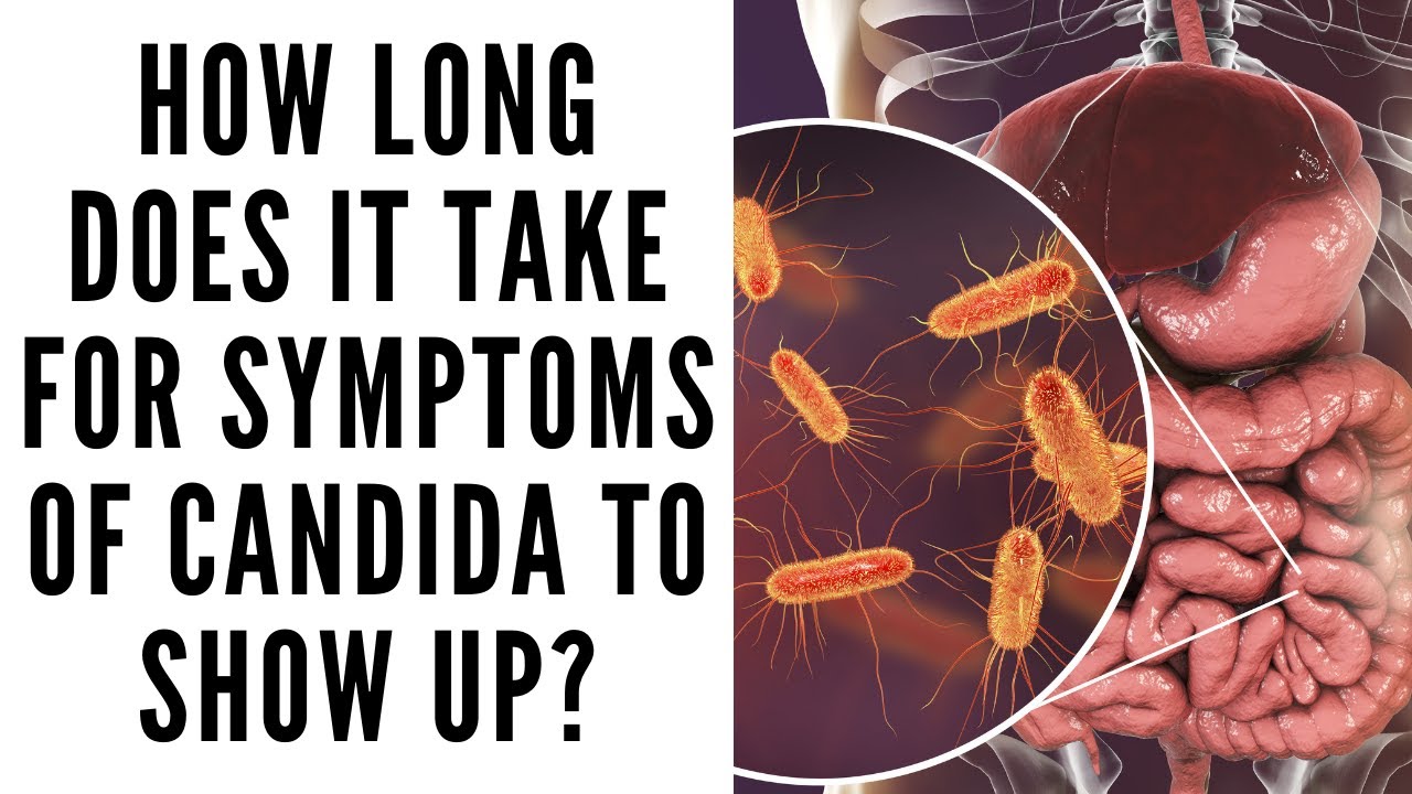 How Long Does It Take For Symptoms Of Candida To Show Up ...