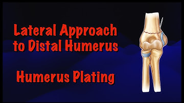 Lateral Approach to Distal Humerus: Humerus Plating Surgical Technique | Dr. Deepak Garg