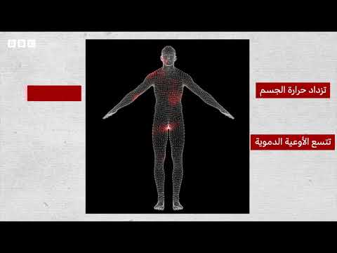 تأثير موجات الحر على الجسم: ما الذي يحدث؟