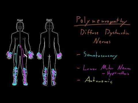 Video: Polyneuropati Hos Børn - Arvelig Polyneuropati, Polyneuropati Syndrom