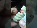 How to check the fitting of the inner crowns? full arch restoration