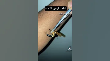 شاهد قرص النحله للانسان Shorts Short Foryou Bug Wasp Insects Animals Seting Venom Fyp Fy 