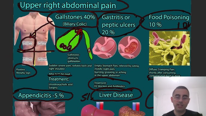 Why am I getting pain over the SIDE of my RIBS? 