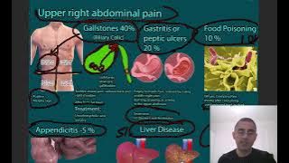 Right Upper abdominal Pain Symptoms, causes and treatment.