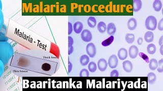 Malaria procedure | Baaritaanka Malariyada| Microscopic| Malaria under microscope|