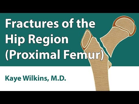 Fractures Of The Hip Region (Proximal Femur)