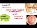 Acute Suppurative Otitis Media ASOM ENT Easy Explanation Stages Diagnosis Management Acute Suppurative Otitis Media ASOM ENT Easy Explanation Stages Diagnosis Management