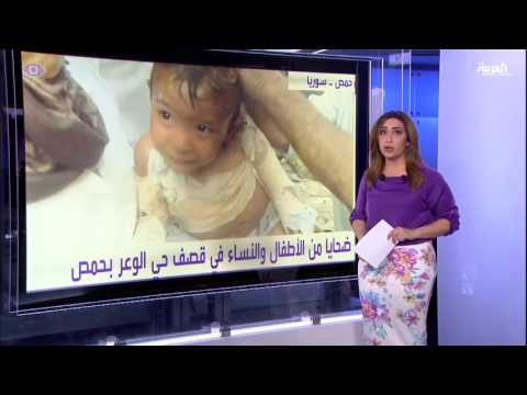 أنا أرى ضحايا من الأطفال والنساء في قصف حي الوعر