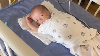 Akron baby battling rare condition