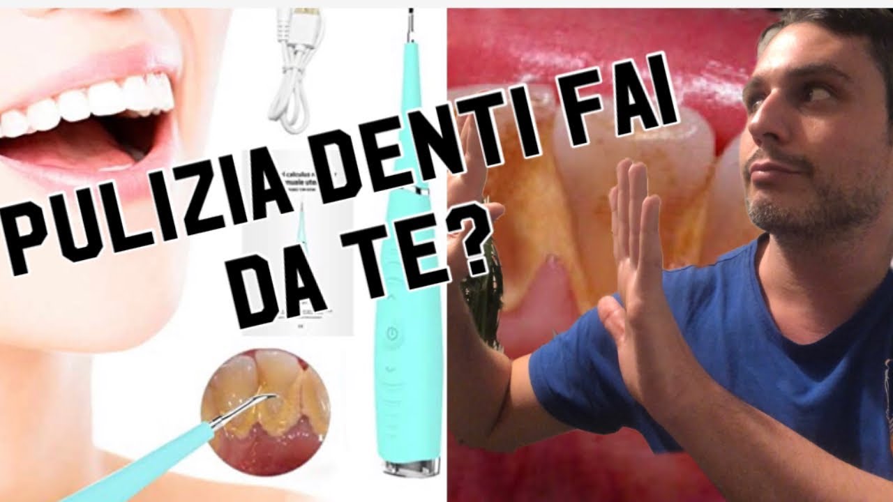 Pulizia Dei Denti Fai Da Te YouTube Pulizia Dei Denti Fai Da Te YouTube