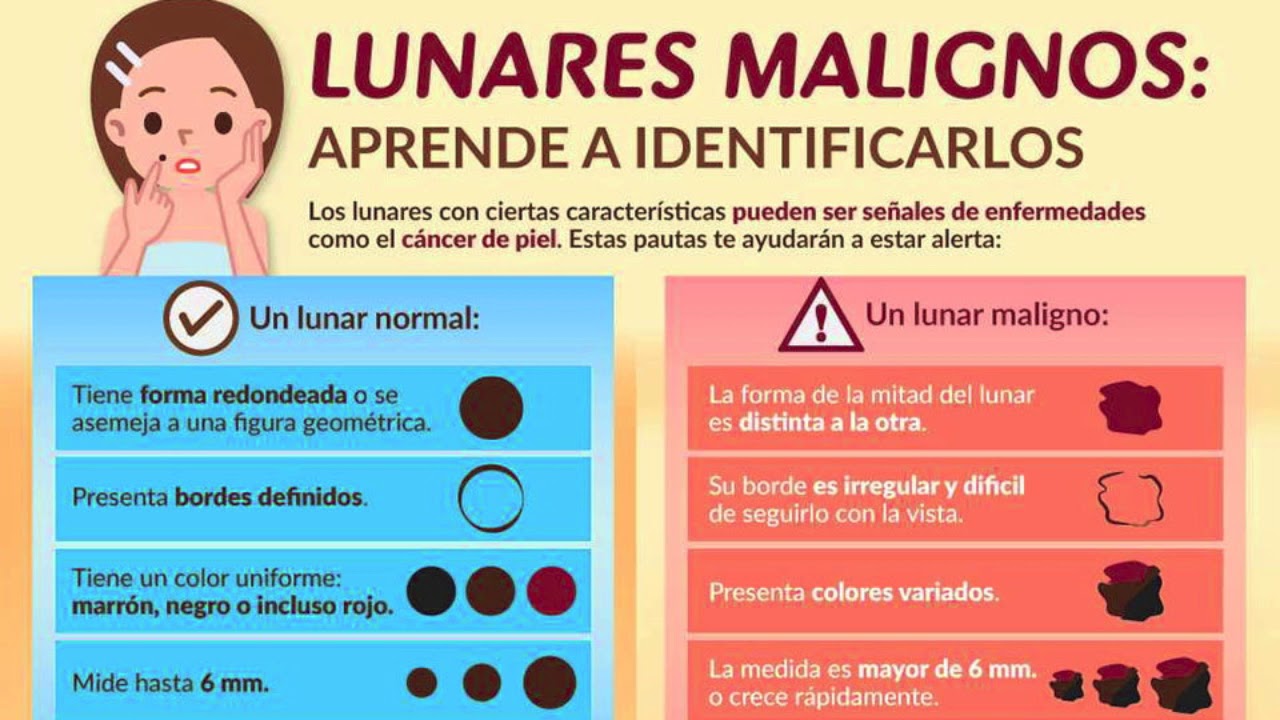 Cosas malas de cancer