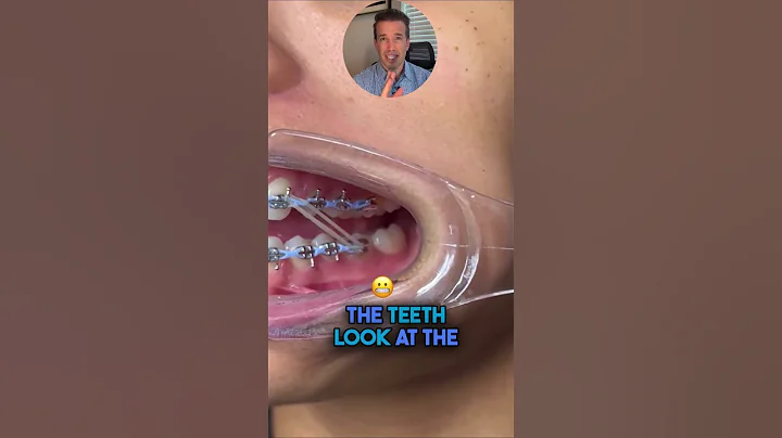 Rubber bands #shorts