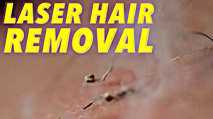 Science of Laser Hair Removal in SLOW MOTION - DayDayNews