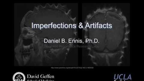2017 M219 Lecture 14 -Imperfections & Artifacts (Dr. Daniel Ennis)