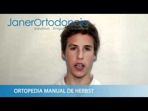 Ortodoncia con Aparato Herbst: Marco, de 15 aos, n...