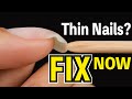 How to Fix Thin Nails – Fast & Easy!💅【ASKA NAILS】