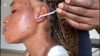 ASMR EAR CLEANING AND NITPICKING, SPIT PAINTING, EAR LICKING, EAR EATING, EAR BITTING, SCALP SCRATCH