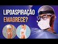 VEJA TUDO SOBRE A LIPOASPIRAÇÃO E COMO PODE TE AJUDAR!