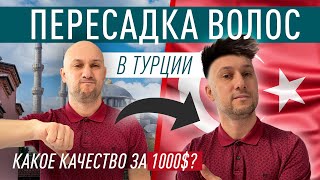 Пересадка волос в Турции. Основные вопросы. Цена - 1000 USD?