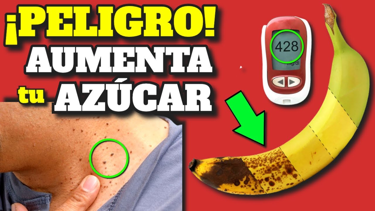 CU�L ES LA MEJOR BANANA y CUANTAS DEBES COMER POR DIA| FRUTA PARA LA DIABETES y ADELGAZAR