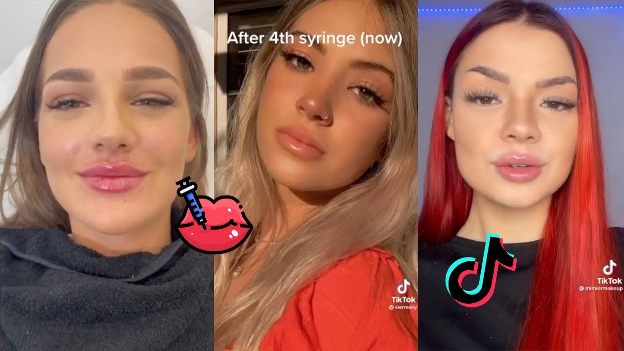 Lip Filler TikTok Compilation LIP FILLER Check 👄 YouTube