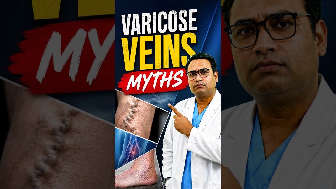 Varicose Veins Biggest Myth Debunked! ❌ Mens Health Tips