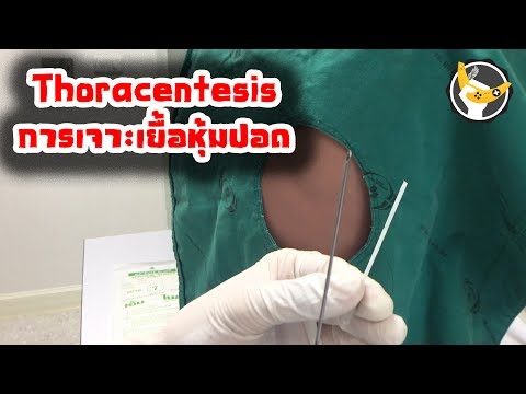 การเจาะโพรงเยื่อหุ้มปอด (Thoracentesis) by OuixZ