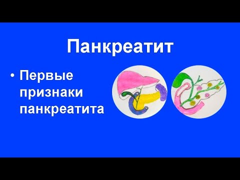 Первые признаки панкреатита/Тревожные сигналы поджелудочной железы