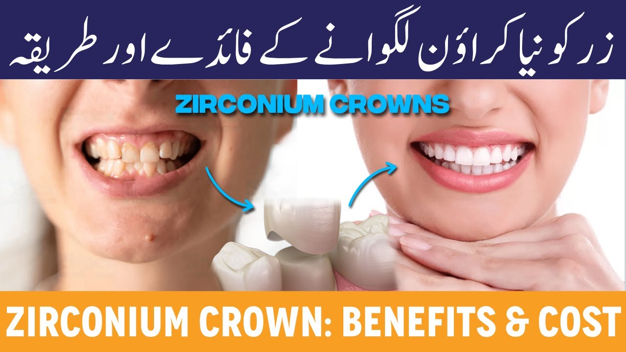 What Is Zirconium Crown & Its Advantages - Zirconia Crown Kaise Lagate Hain - Zirconium Crown Cost