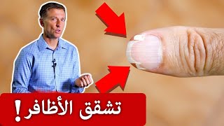 نقص هذا العنصر يسبب تشقق وتقصف الاظافر!