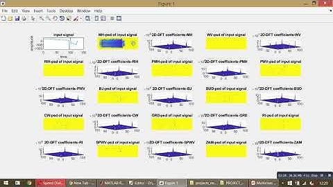 Multiclass Epileptic Seizure Classification Using Time-Frequency Analysis of EEG Signals