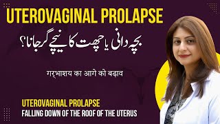 Bacha Dani Ya Chatt Ka Niche Gir Jana | Uterovaginal Prolapse in Urdu/Hindi screenshot 3