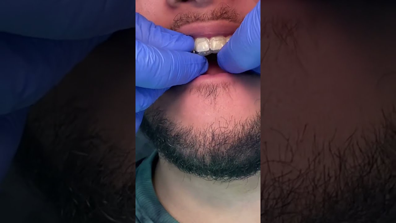 VOCÊ CONHECE O APARELHO INVISÍVEL?