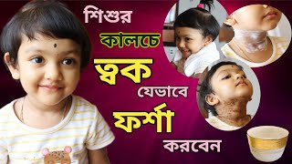 How To Make Baby Fair From Dark Skin || 3 Step Fairness Remedies (Bengali)