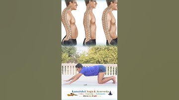 Correct Your spine shape #lordosis #kyposis #spinalinjury