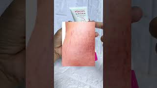 Stretch marks serum & cream